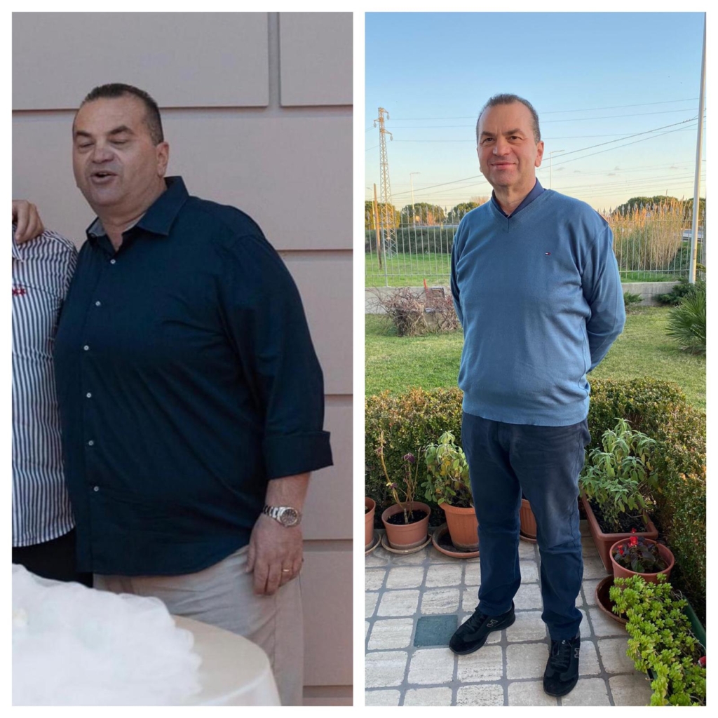 before and after